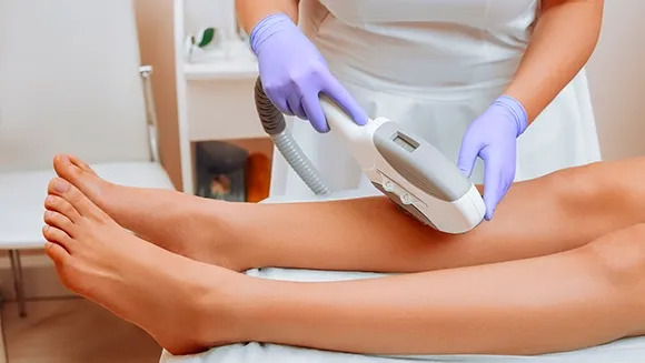Laser Hair removal being done at Dermys Clinic Nagpur